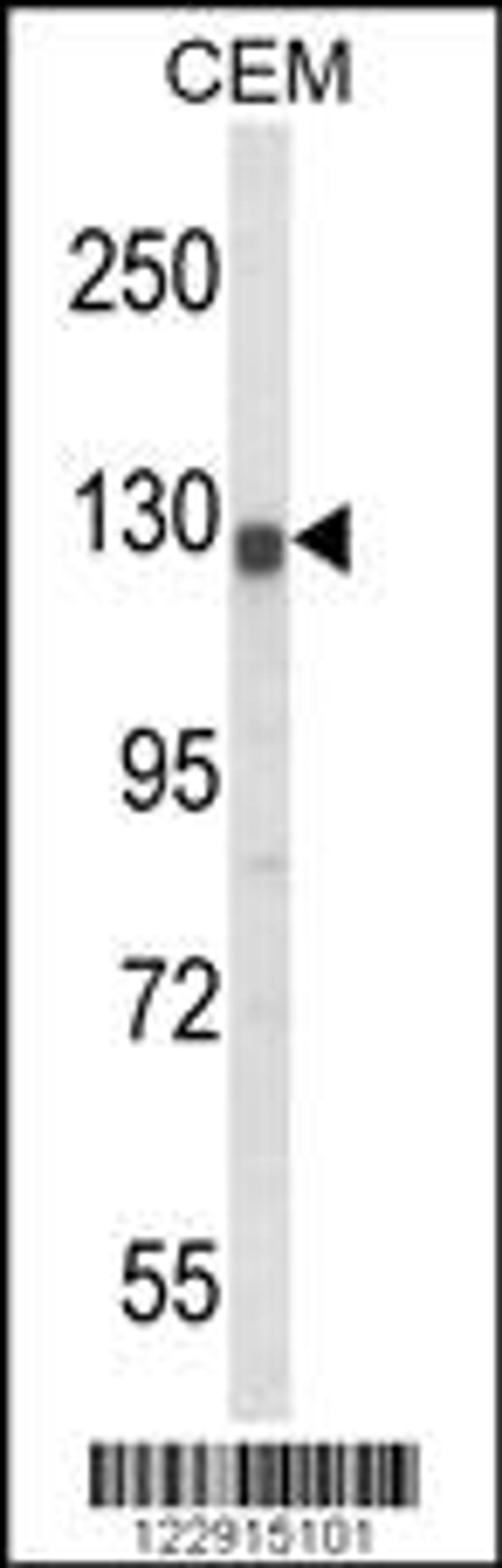 Western blot analysis of KCNH2 Antibody in CEM cell line lysates (35ug/lane)