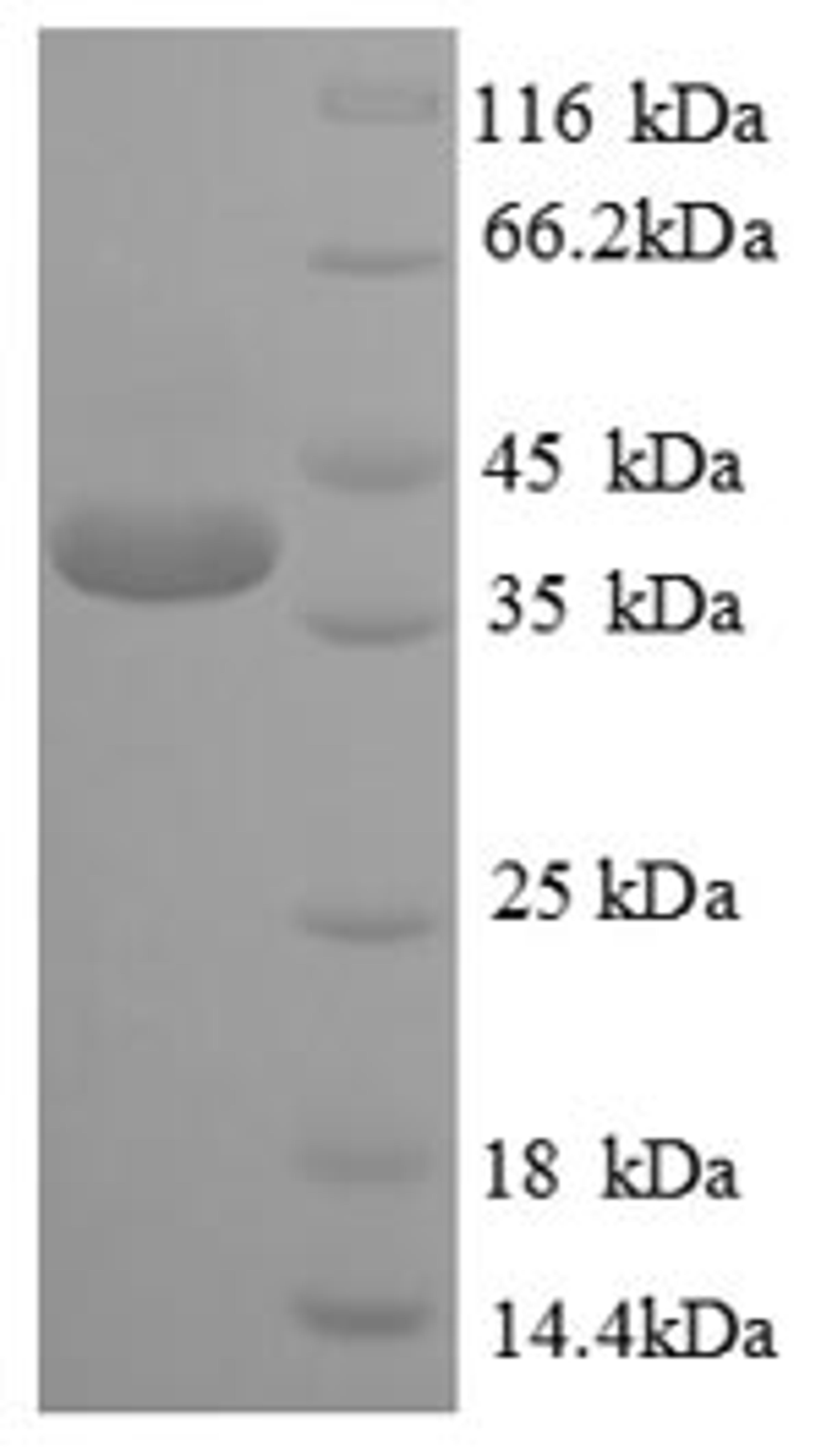 (Tris-Glycine gel) Discontinuous SDS-PAGE (reduced) with 5% enrichment gel and 15% separation gel.