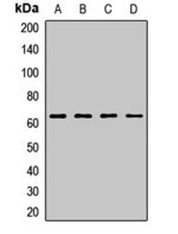 Western blot analysis of Hela (Lane1), A549 (Lane2), mouse brain (Lane3), rat ovary (Lane4) whole cell lysates using ITPRIP antibody