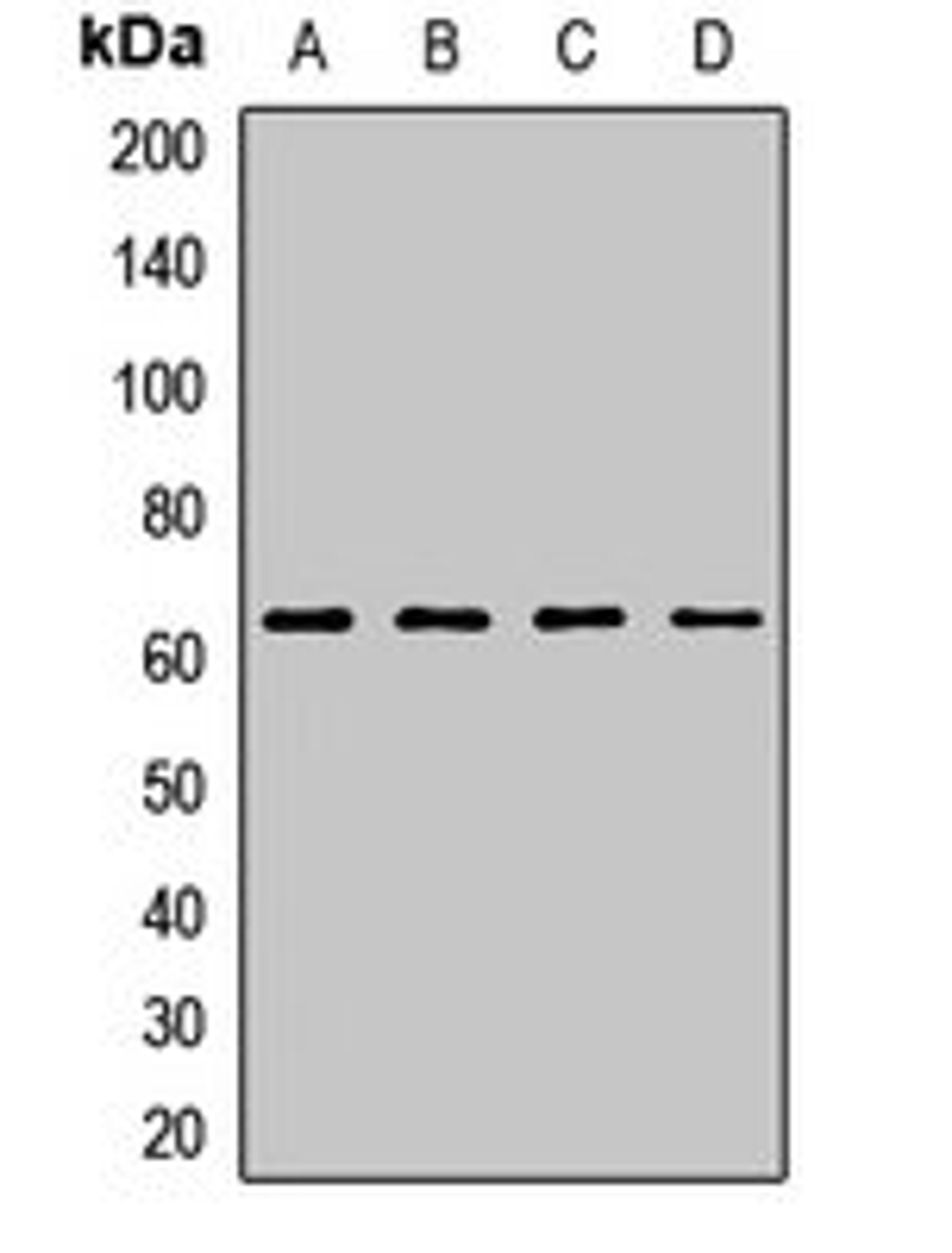 Western blot analysis of Hela (Lane1), A549 (Lane2), mouse brain (Lane3), rat ovary (Lane4) whole cell lysates using ITPRIP antibody