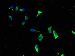 Immunofluorescence staining of SH-SY5Y cells with CSB-PA012695LA01HU at 1:133, counter-stained with DAPI. The cells were fixed in 4% formaldehyde, permeabilized using 0.2% Triton X-100 and blocked in 10% normal Goat Serum. The cells were then incubated with the antibody overnight at 4°C. The secondary antibody was Alexa Fluor 488-congugated AffiniPure Goat Anti-Rabbit IgG(H+L).
