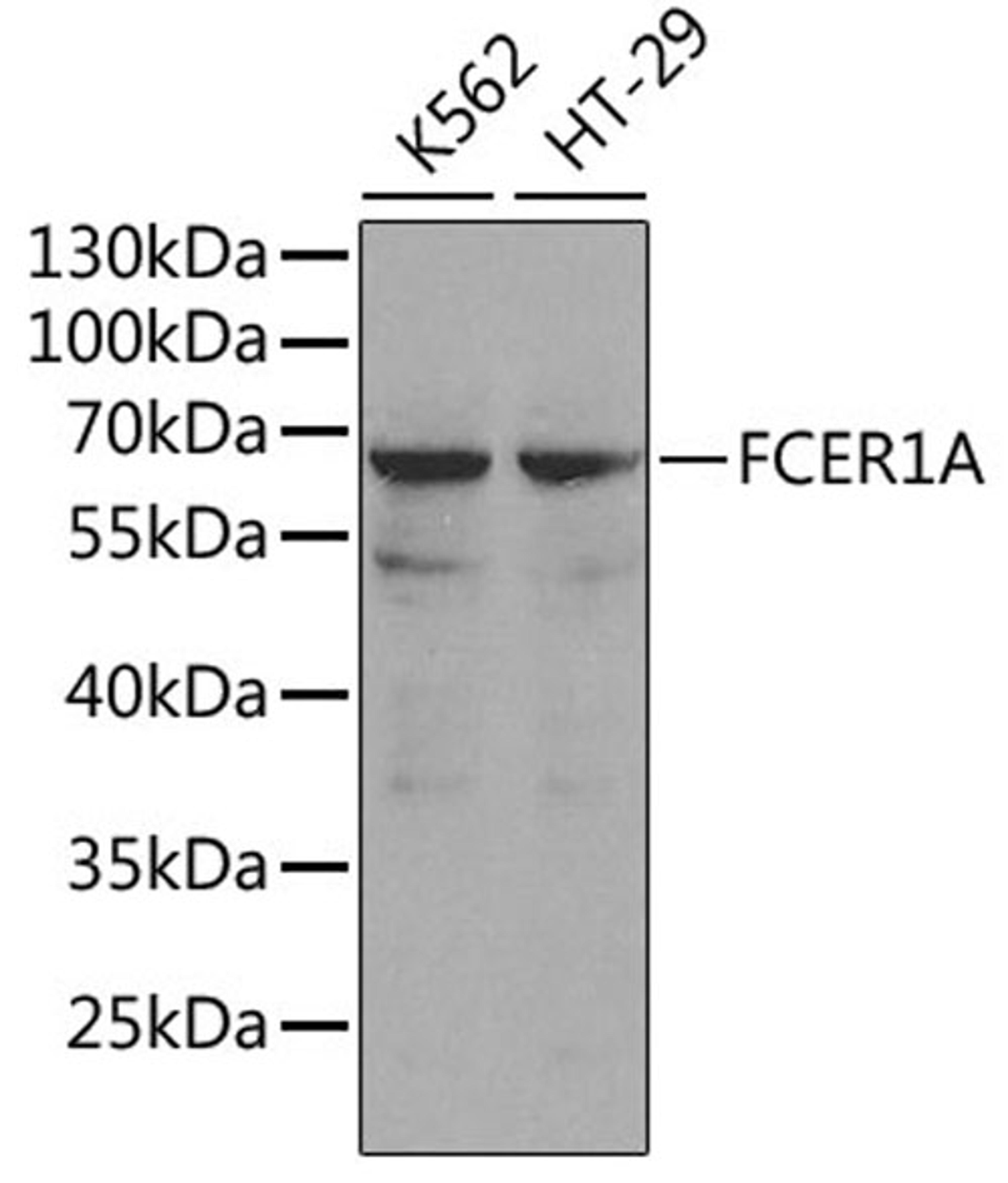 Western blot - FCER1A antibody (A1751)