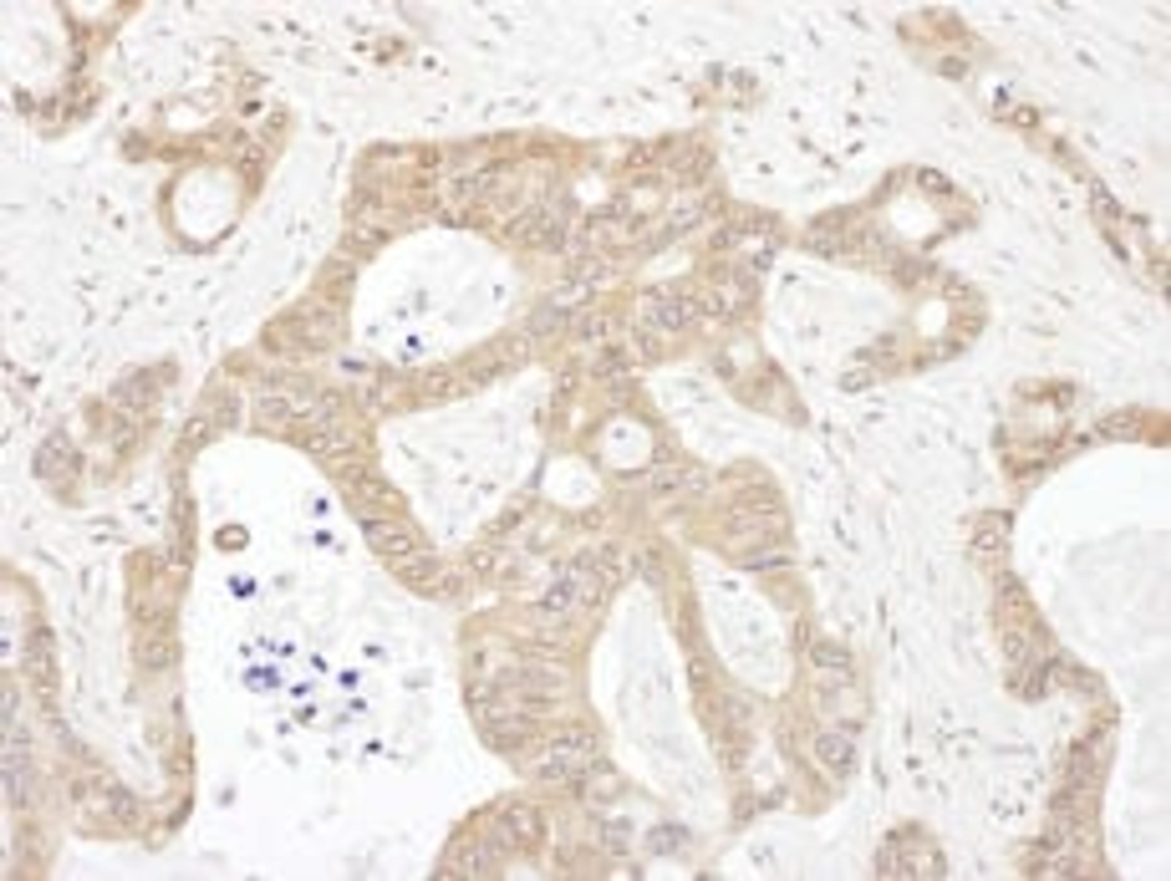 Detection of human LARS by immunohistochemistry.