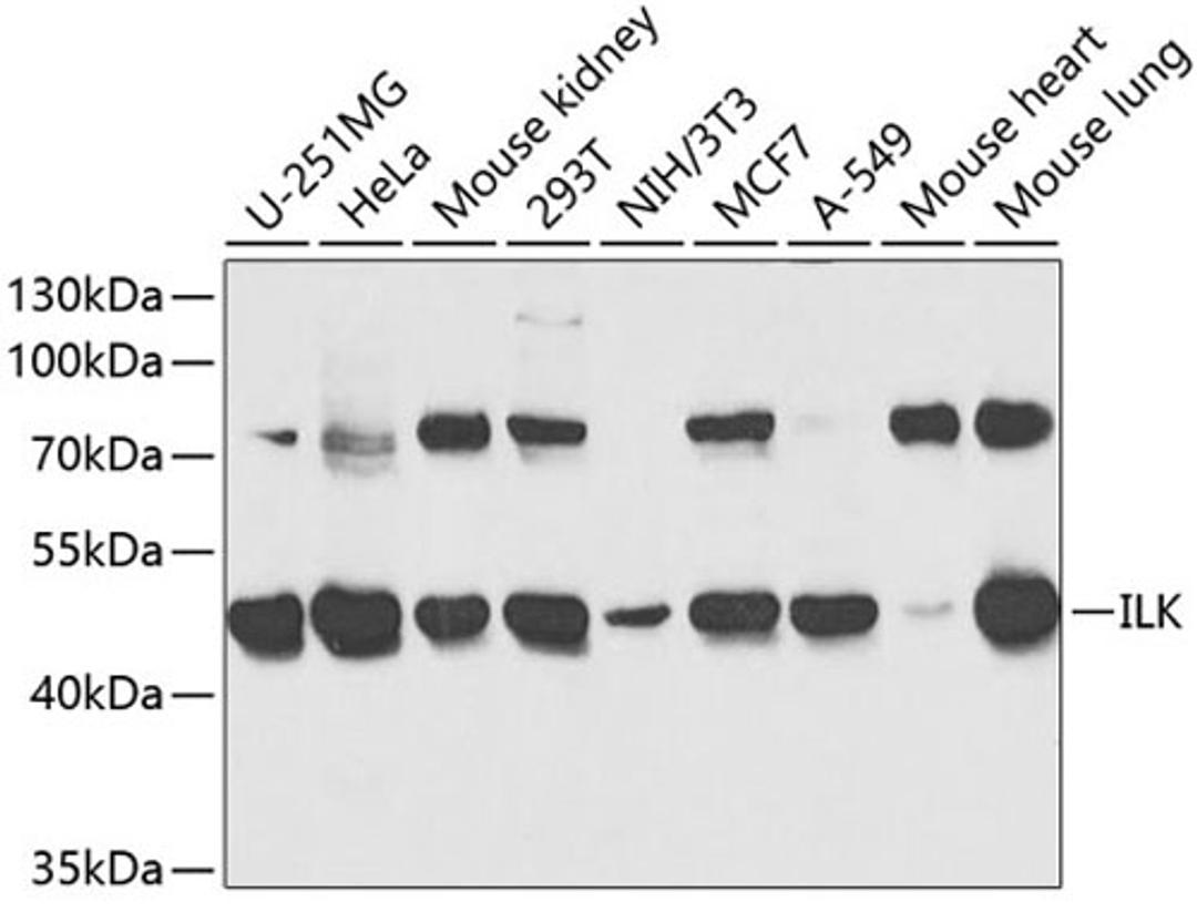 Western blot - ILK antibody (A0901)