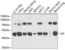 Western blot - ILK antibody (A0901)