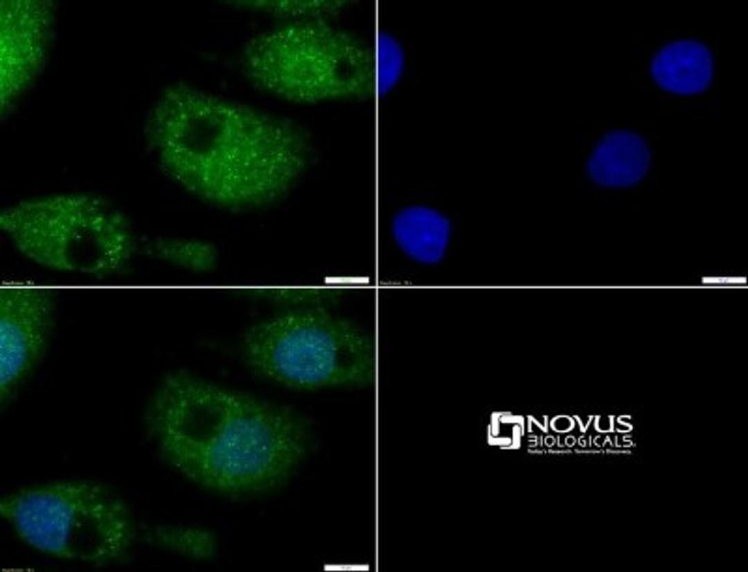 Immunocytochemistry/Immunofluorescence: MUC-4 Antibody [NBP1-52193] - ICC staining of MUC4 in HepG2 cells with FITC (green). Nuclei were counterstained with DAPI (blue).