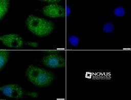 Immunocytochemistry/Immunofluorescence: MUC-4 Antibody [NBP1-52193] - ICC staining of MUC4 in HepG2 cells with FITC (green). Nuclei were counterstained with DAPI (blue).