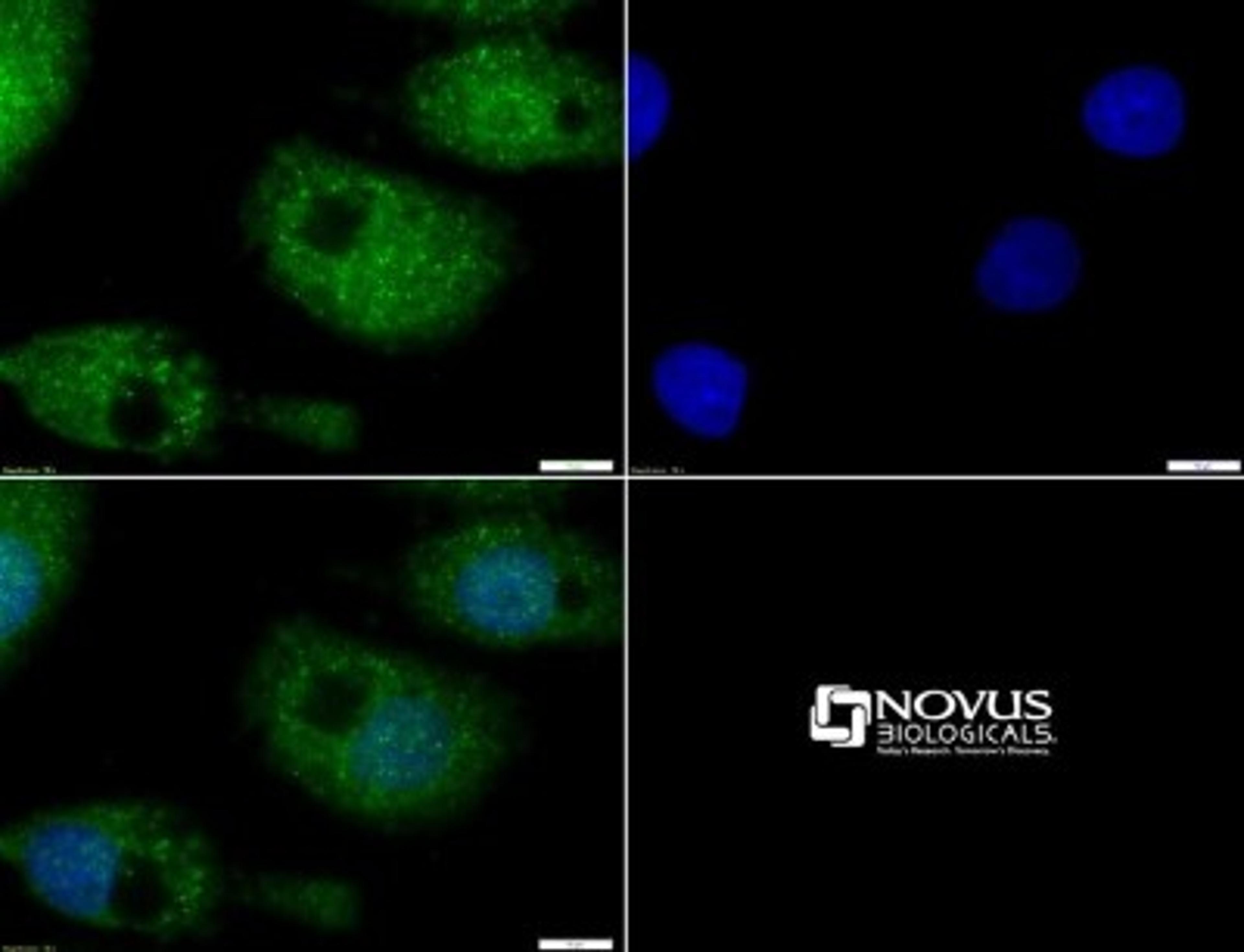 Immunocytochemistry/Immunofluorescence: MUC-4 Antibody [NBP1-52193] - ICC staining of MUC4 in HepG2 cells with FITC (green). Nuclei were counterstained with DAPI (blue).