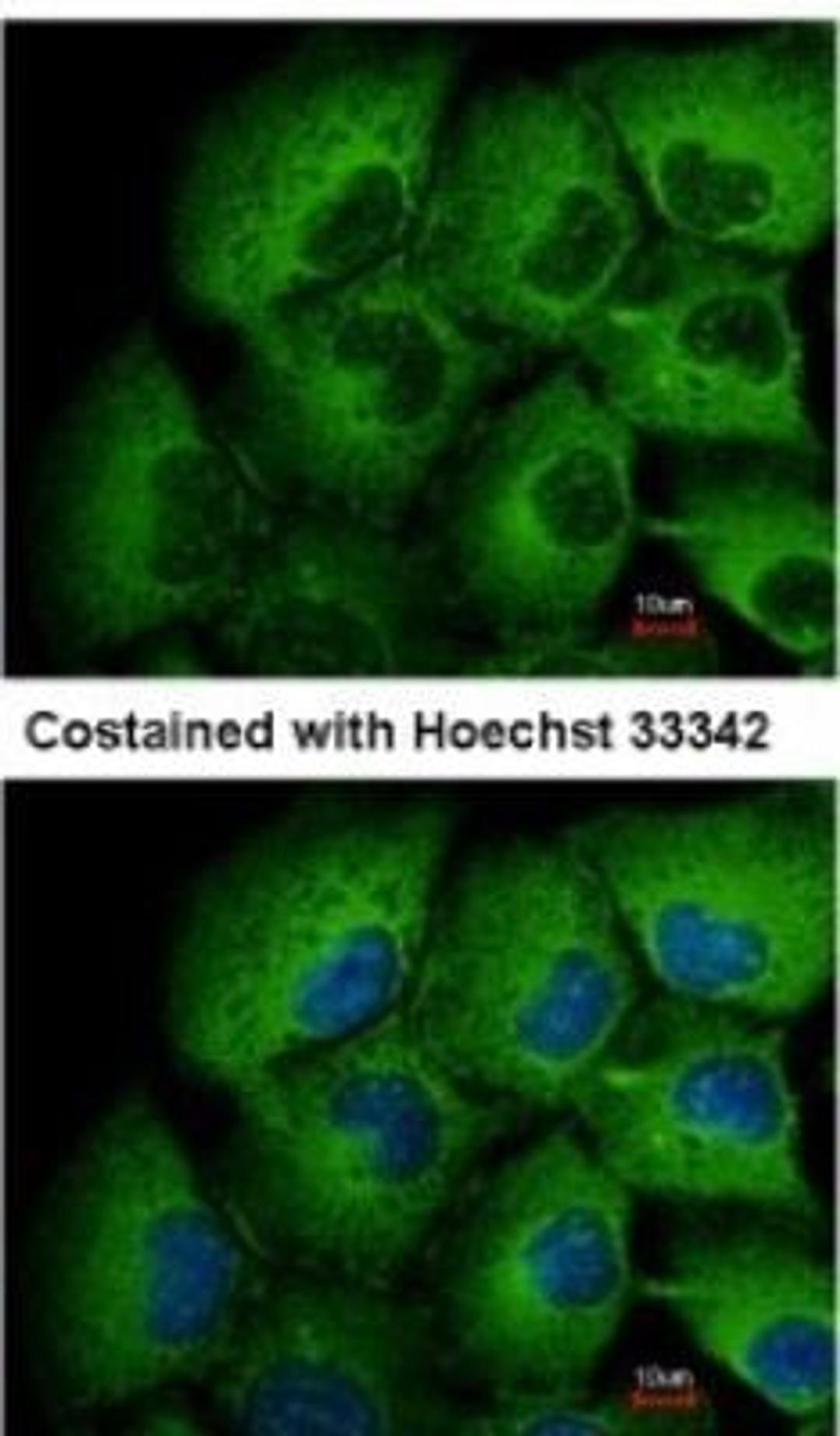 Immunocytochemistry/Immunofluorescence: MMP-12 Antibody [NBP1-31225] -  Analysis of methanol-fixed H1299, using antibody at 1:500 dilution.