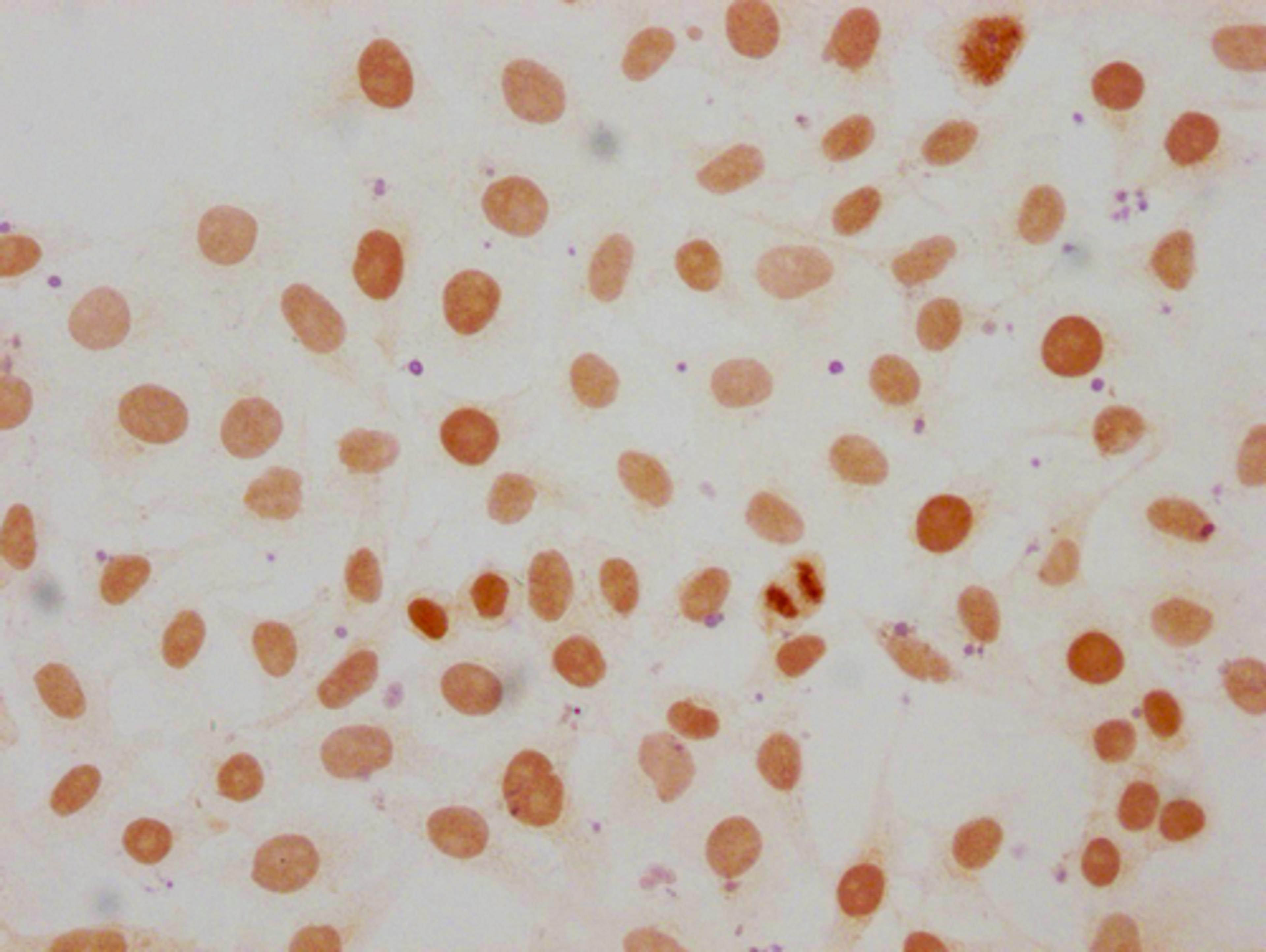 Immunocytochemistry analysis of CSB-PA010087OA107me1HU diluted at 1:50 and staining in Hela cells performed on a Leica BondTM system. The cells were fixed in 4% formaldehyde, permeabilized using 0.2% Triton X-100 and blocked with 10% normal goat serum 30min at RT. Then primary antibody (1% BSA) was incubated at 4°C overnight. The primary is detected by a biotinylated secondary antibody and visualized using an HRP conjugated SP system.