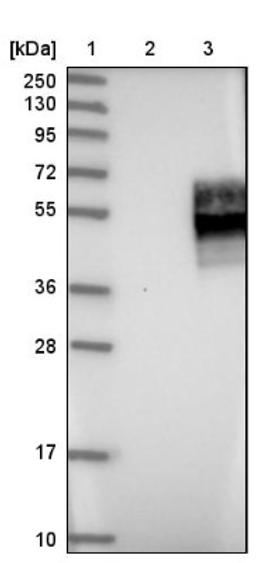 Western Blot: IFN gamma Receptor beta Antibody [NBP1-90223] - Lane 1: Marker [kDa] 250, 130, 95, 72, 55, 36, 28, 17, 10<br/>Lane 2: Negative control (vector only transfected HEK293T lysate)<br/>Lane 3: Over-expression lysate (Co-expressed with a C-terminal myc-DDK tag (~3.1 kDa) in mammalian HEK293T cells, LY401697)