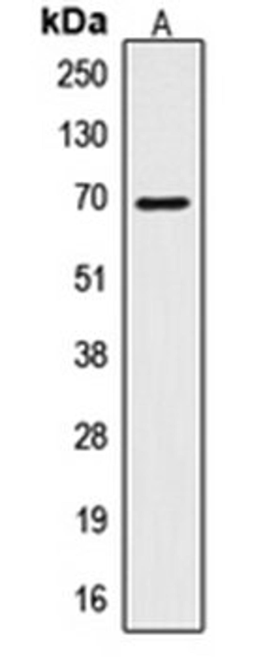 Western blot analysis of HepG2 (Lane 1) whole cell lysates using CTPS1 antibody