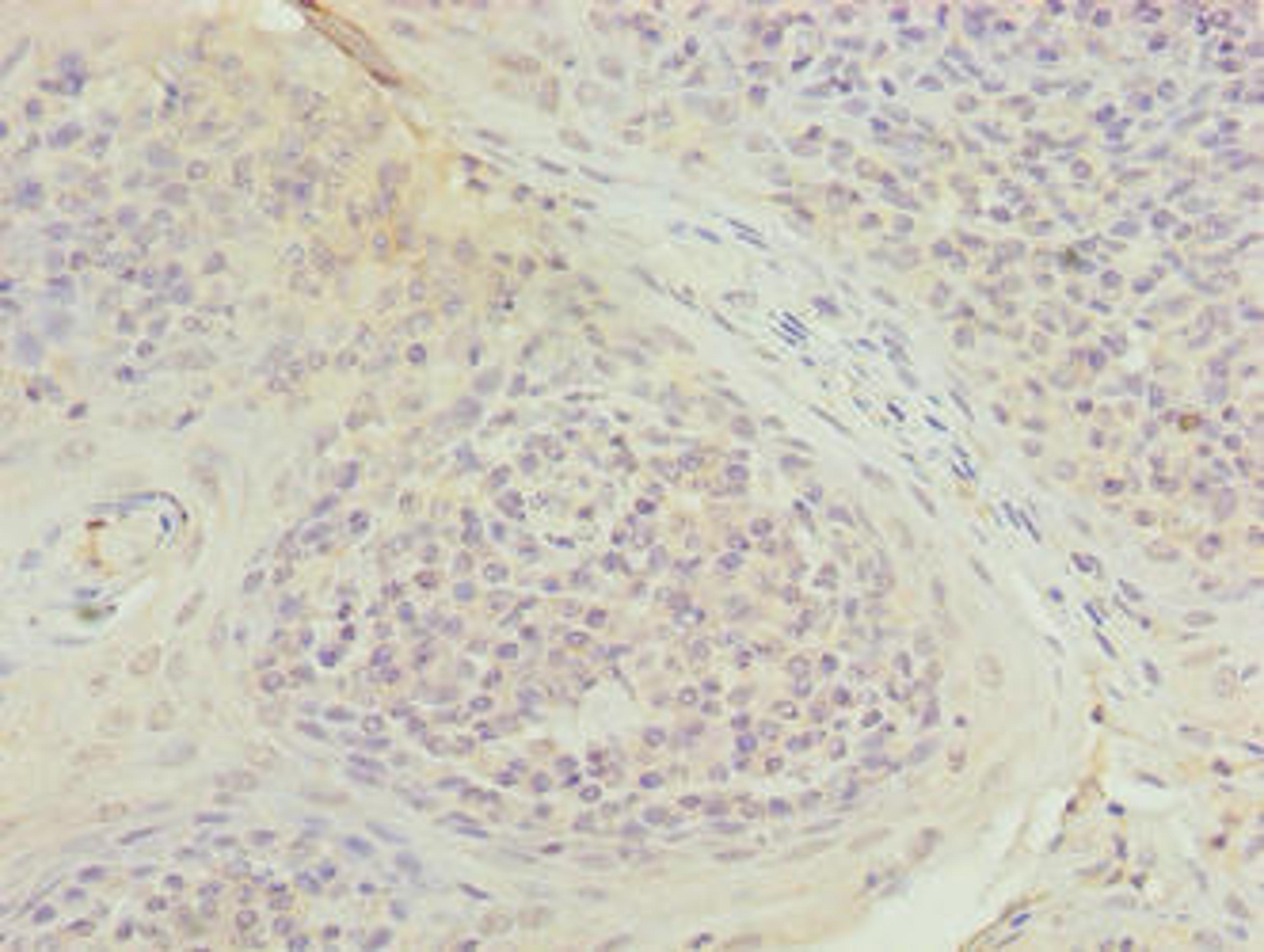 Immunohistochemistry of paraffin-embedded human tonsil tissue using CSB-PA867148LA01HU at dilution of 1:100