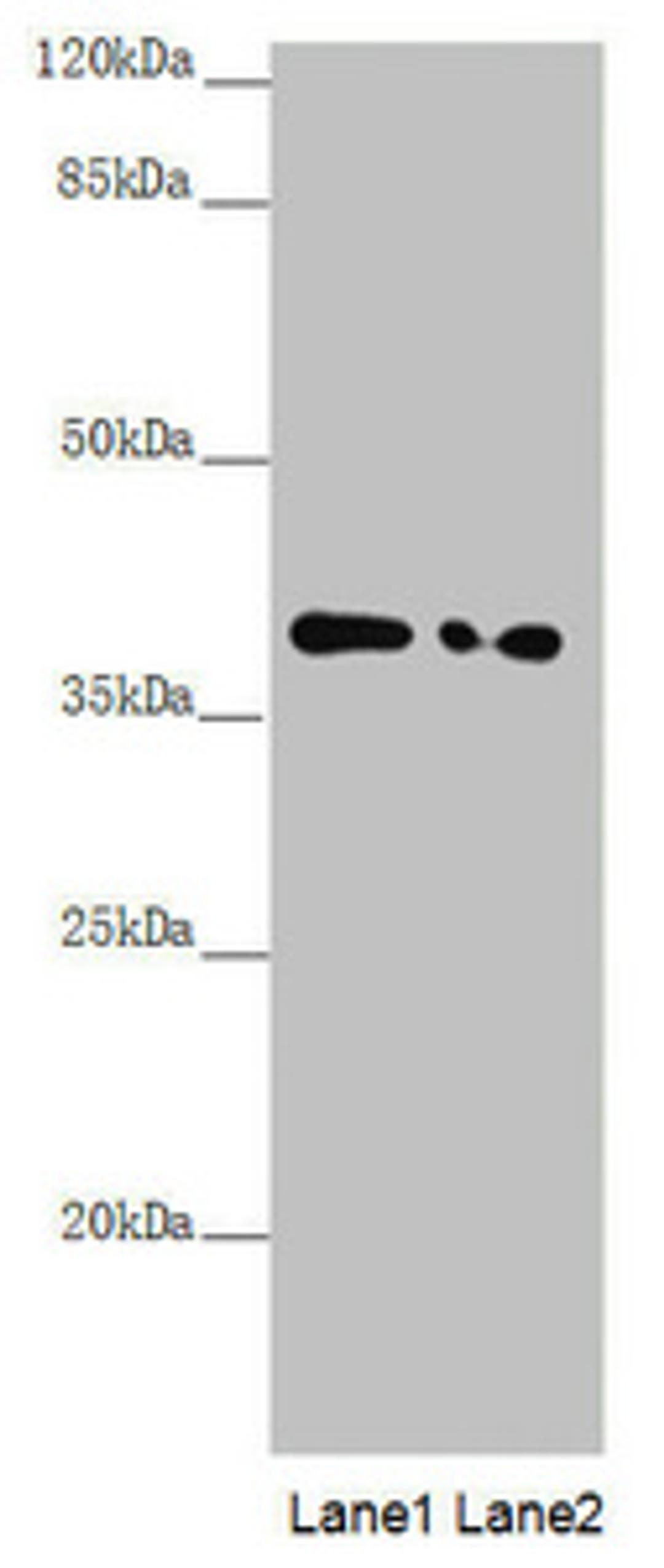 Western blot. All lanes: PPP1R8 antibody at 1.11µg/ml. Lane 1: PC-3 whole cell lysate. Lane 2: HL60 whole cell lysate. Secondary. Goat polyclonal to rabbit IgG at 1/10000 dilution. Predicted band size: 39, 23, 14 kDa. Observed band size: 39 kDa