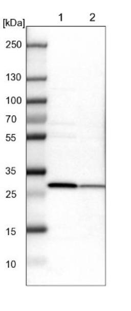 Western Blot: ETFB Antibody [NBP1-89545] - Lane 1: NIH-3T3 cell lysate (Mouse embryonic fibroblast cells)<br/>Lane 2: NBT-II cell lysate (Rat Wistar bladder tumour cells)