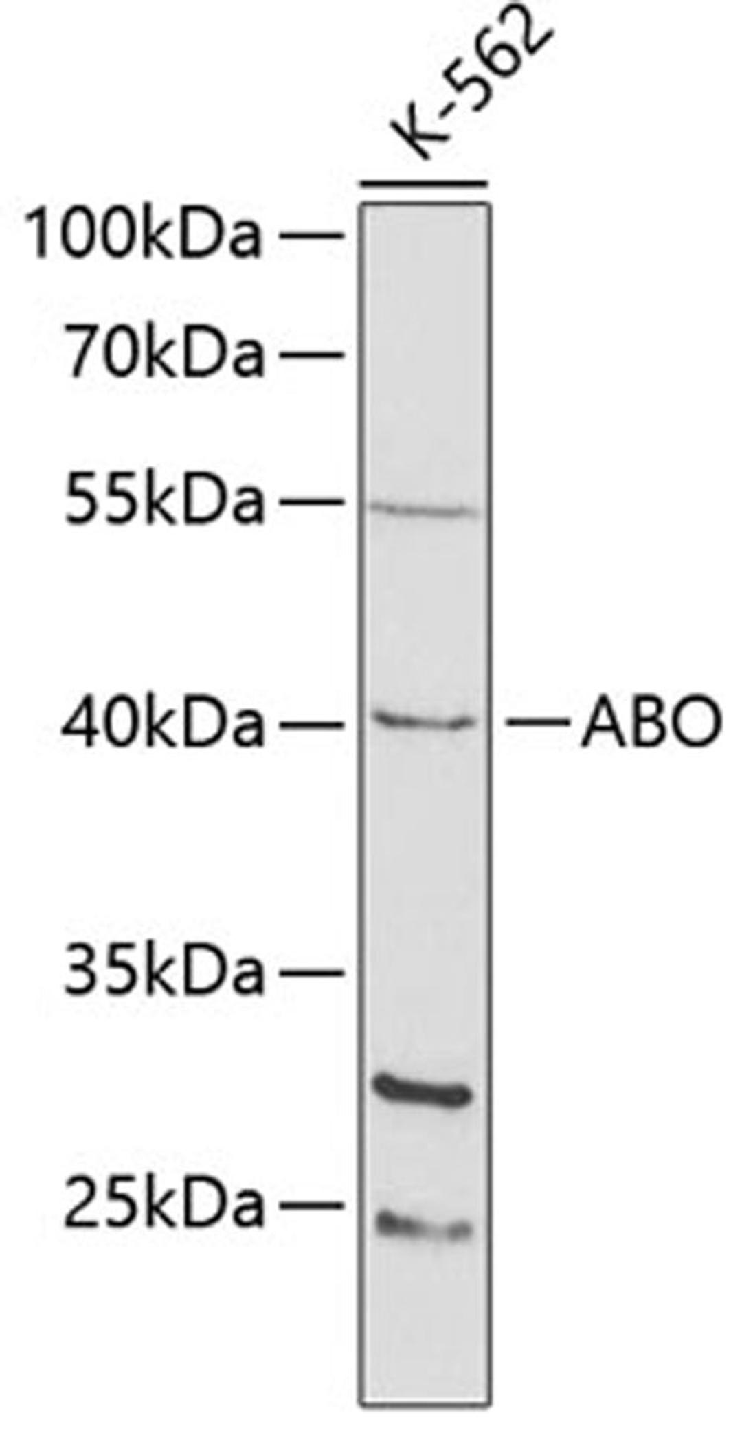 Western blot - ABO antibody (A1586)