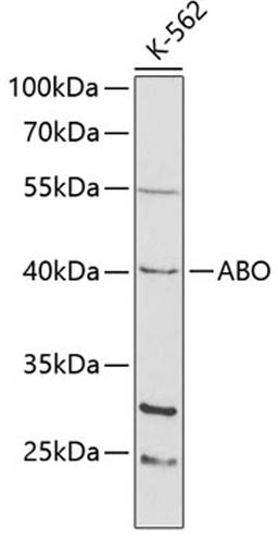 Western blot - ABO antibody (A1586)