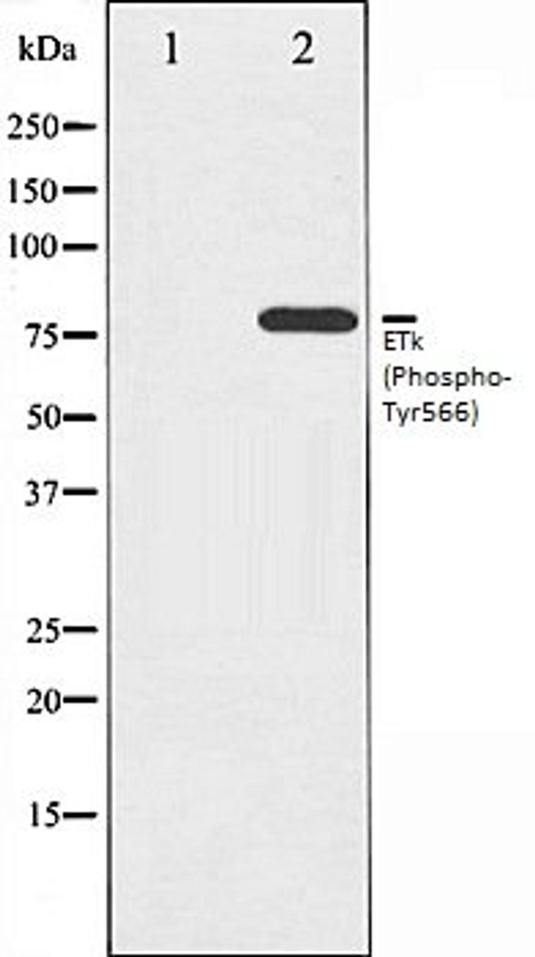 Western blot analysis of HeLa whole cell lysates using ETK (Phospho-Tyr566) antibody, The lane on the left is treated with the antigen-specific peptide.