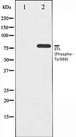 Western blot analysis of HeLa whole cell lysates using ETK (Phospho-Tyr566) antibody, The lane on the left is treated with the antigen-specific peptide.