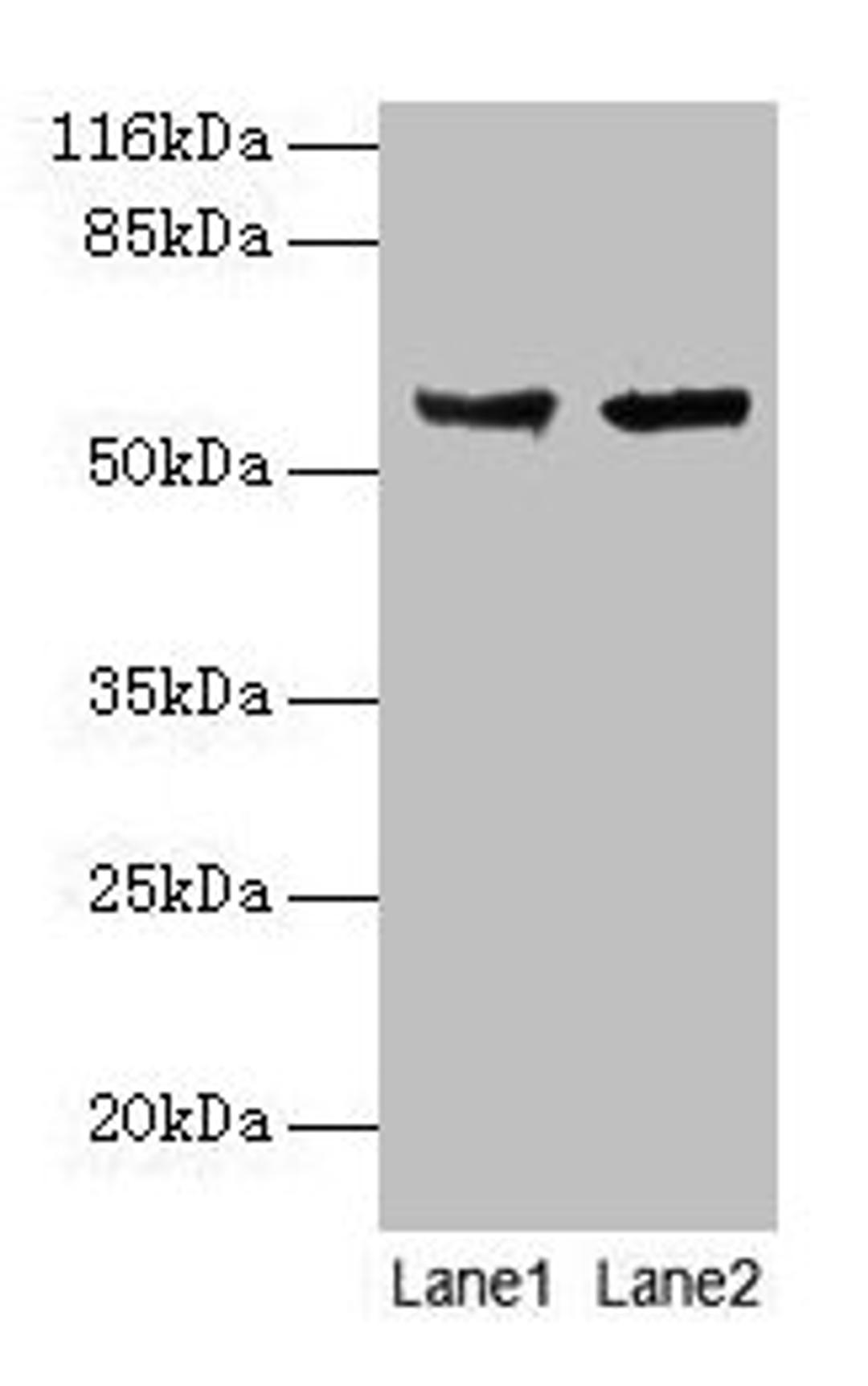 Western blot. All lanes: CYP17A1 antibody at 2µg/ml. Lane 1: Hela whole cell lysate. Lane 2: A549 whole cell lysate. Secondary. Goat polyclonal to rabbit IgG at 1/10000 dilution. Predicted band size: 58 kDa. Observed band size: 58 kDa