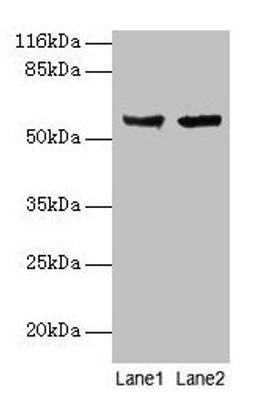 Western blot. All lanes: CYP17A1 antibody at 2µg/ml. Lane 1: Hela whole cell lysate. Lane 2: A549 whole cell lysate. Secondary. Goat polyclonal to rabbit IgG at 1/10000 dilution. Predicted band size: 58 kDa. Observed band size: 58 kDa