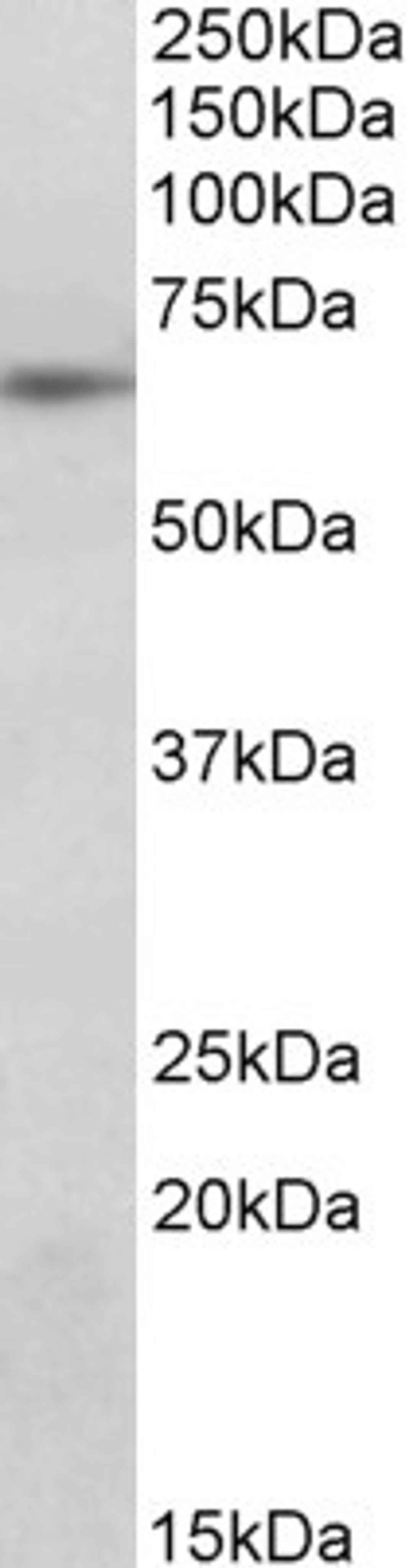 46-411 (0.3ug/ml) staining of Molt4 lysate (35ug protein in RIPA buffer). Primary incubation was 1 hour. Detected by chemiluminescence.