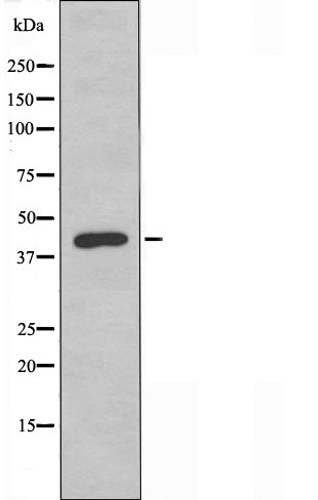 Western blot analysis of Jurkat cells and HUVEC cells using OR2AJ1 antibody