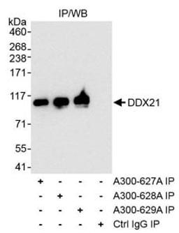 Detection of human DDX21 by western blot of immunoprecipitates.