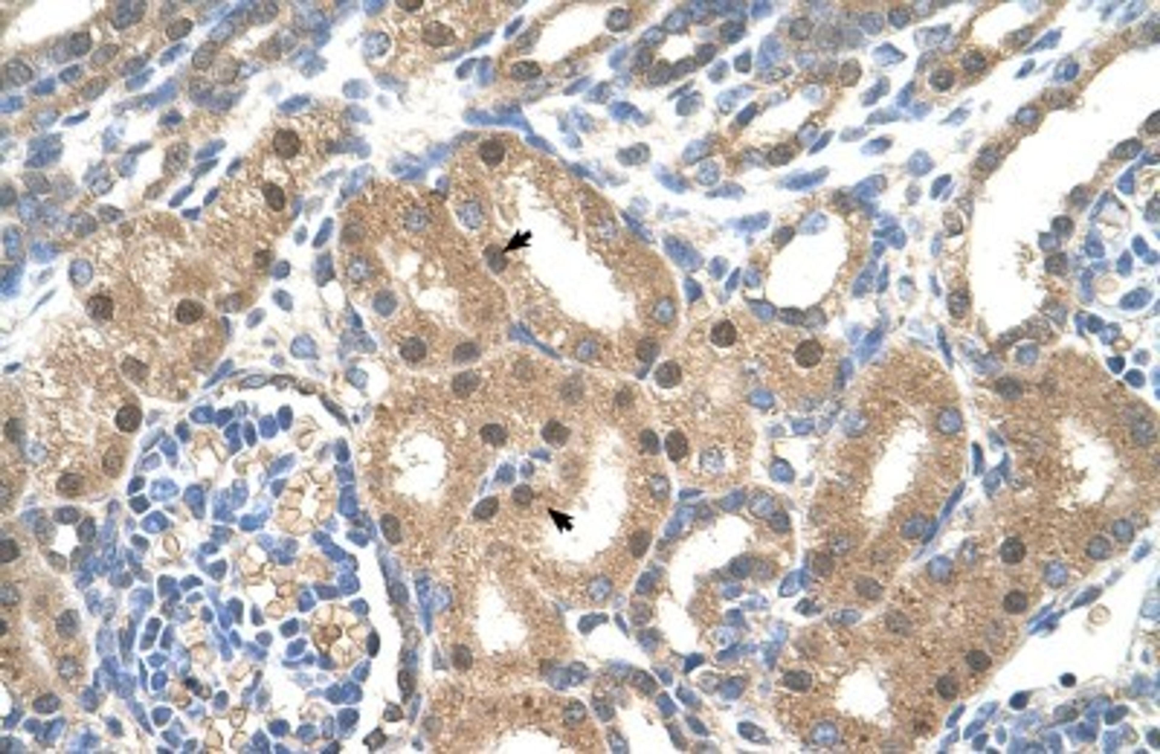 Immunohistochemistry-Paraffin: LIV-1/Zip6 Antibody [NBP1-59357] - Human kidney Tissue, antibody concentration 4-8ug/ml. Cells with positive label: renal corpuscle cells (indicated with arrows) 400X magnification.