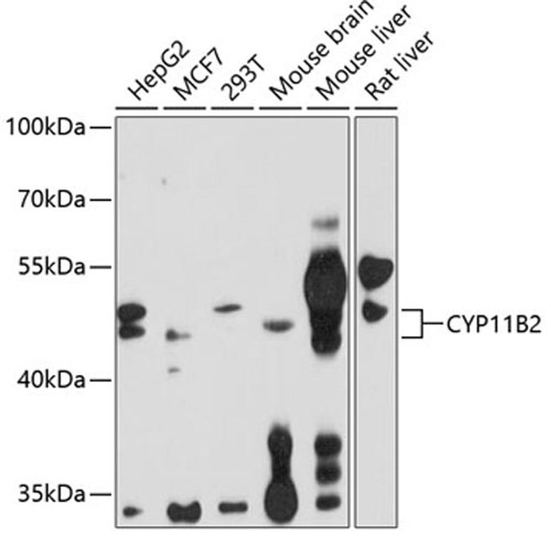 Western blot - CYP11B2 antibody (A1443)