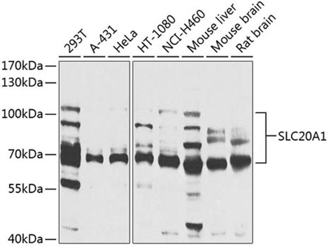 Western blot - SLC20A1 antibody (A4117)