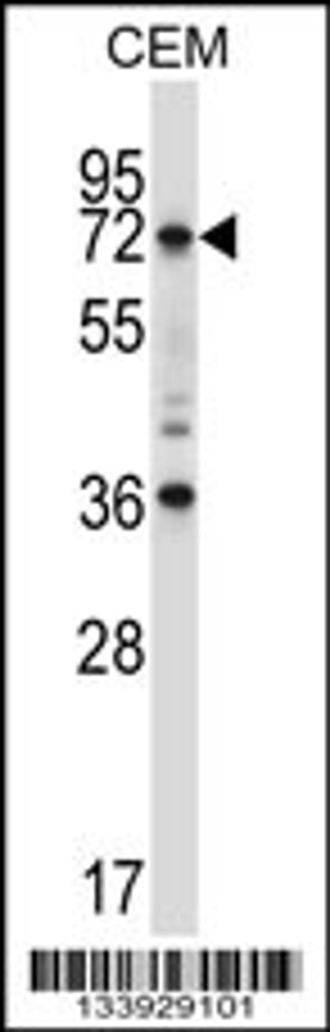 Western blot analysis in CEM cell line lysates (35ug/lane).