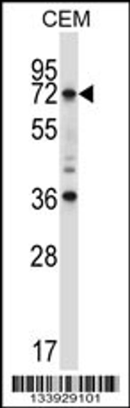 Western blot analysis in CEM cell line lysates (35ug/lane).