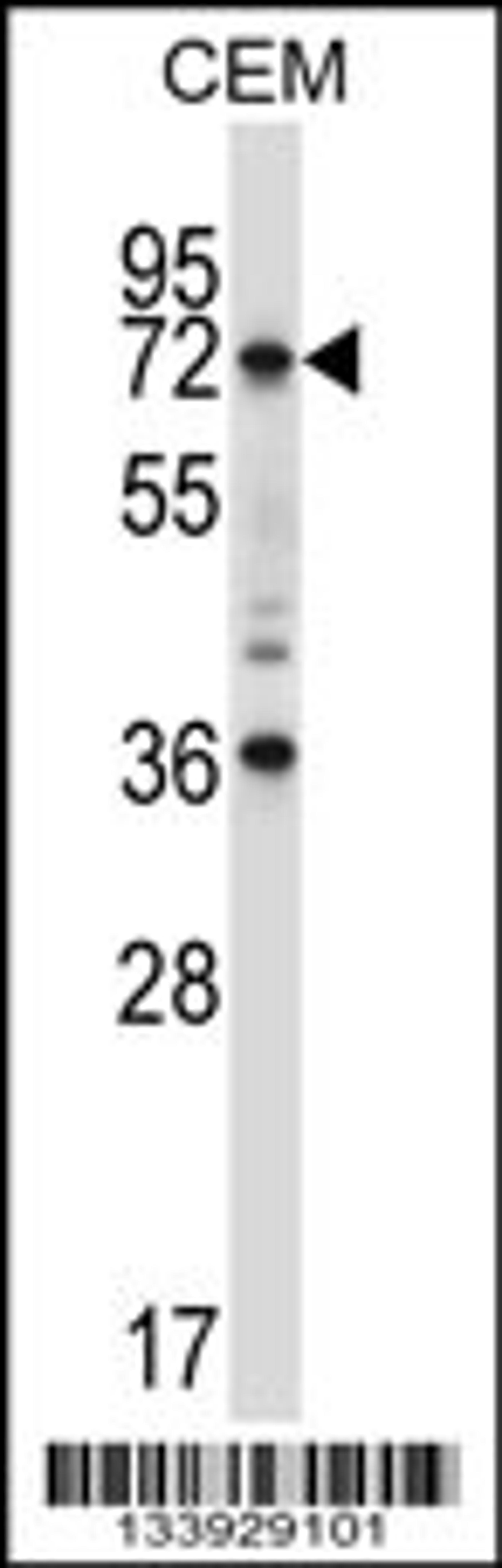 Western blot analysis in CEM cell line lysates (35ug/lane).