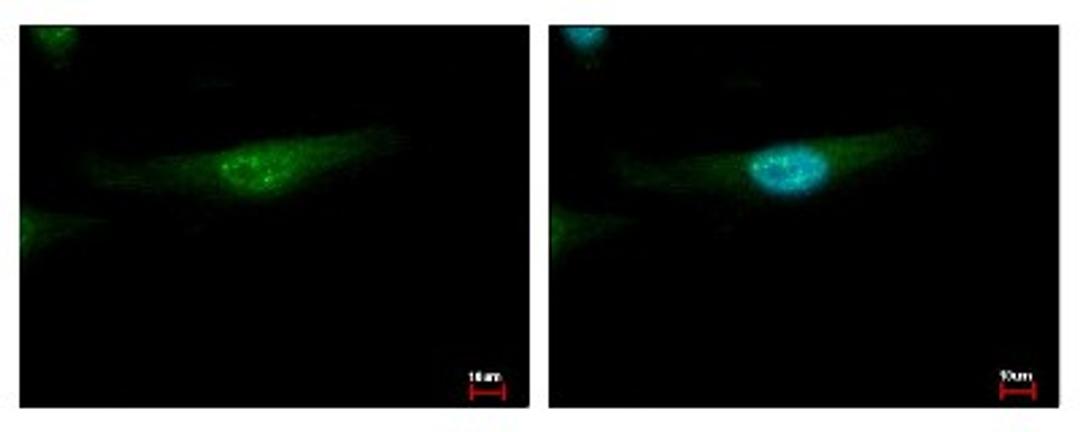 Immunocytochemistry/Immunofluorescence: MSY2 Antibody [NBP2-19422] - Sample: HeLa cells were fixed in iced-cold MeOH for 5 min. Green: YBX2 protein stained by YBX2 antibody, Internal diluted at 1:500. Blue: Hoechst 33343 staining.