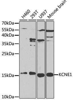 Western blot - KCNE1 antibody (A1176)