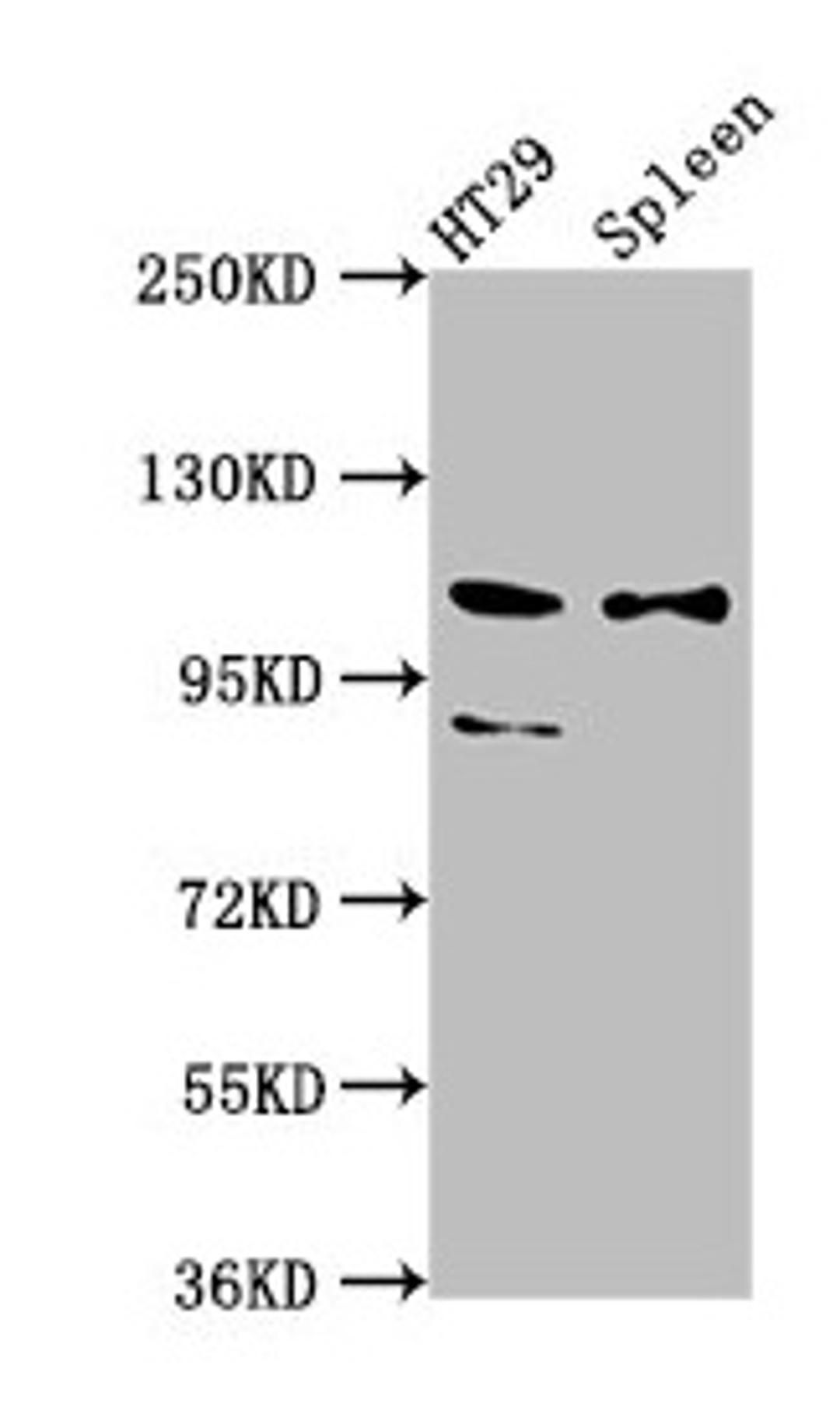 Western Blot. Positive WB detected in: HT29 whole cell lysate, Rat spleen tissue. All lanes: SCUBE2 antibody at 8.7µg/ml. Secondary. Goat polyclonal to rabbit IgG at 1/50000 dilution. Predicted band size: 110, 107, 89 kDa. Observed band size: 110, 89 kDa
