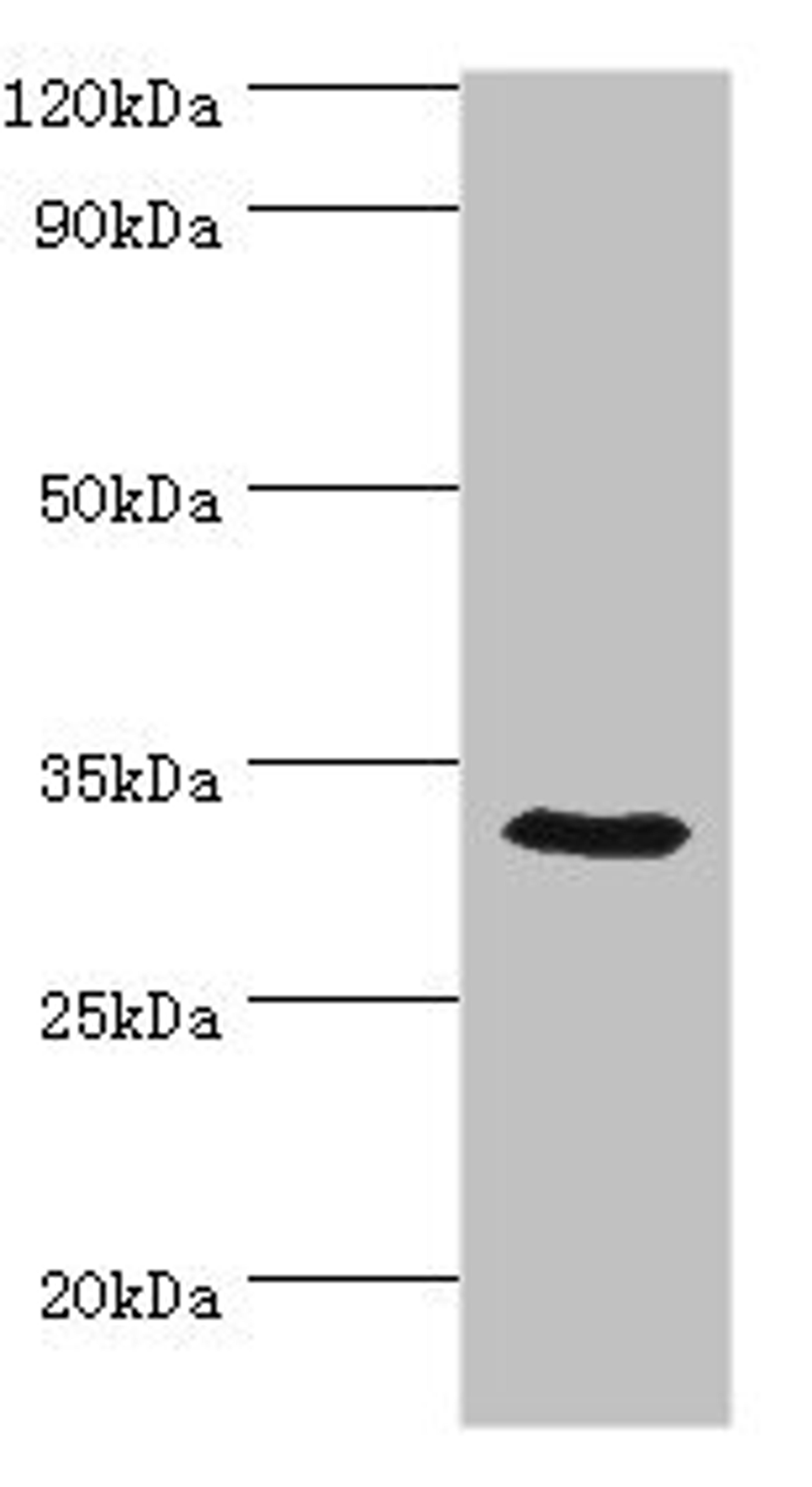 Western blot. All lanes: CA8 antibody at 8ug/ml + Mouse liver tissue. Secondary. Goat polyclonal to rabbit IgG at 1/10000 dilution. Predicted band size: 33 kDa. Observed band size: 33 kDa. 