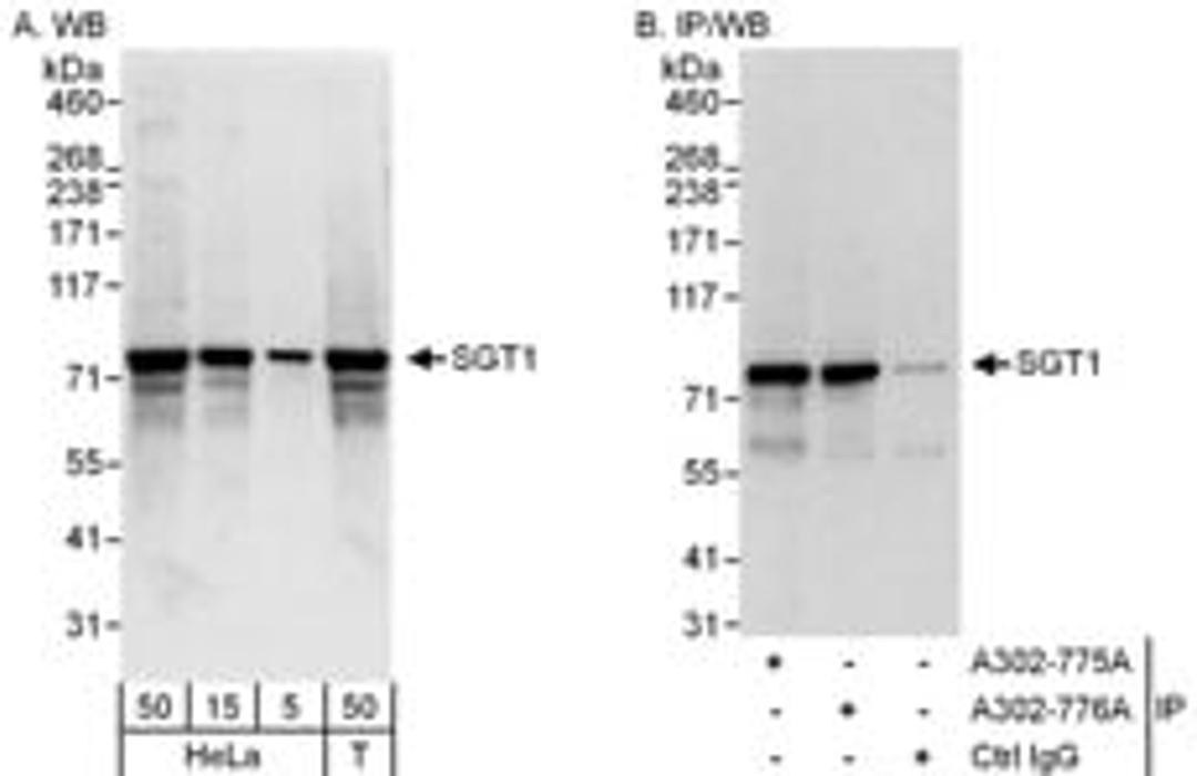 Detection of human SGT1 by western blot and immunoprecipitation.