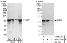 Detection of human SGT1 by western blot and immunoprecipitation.