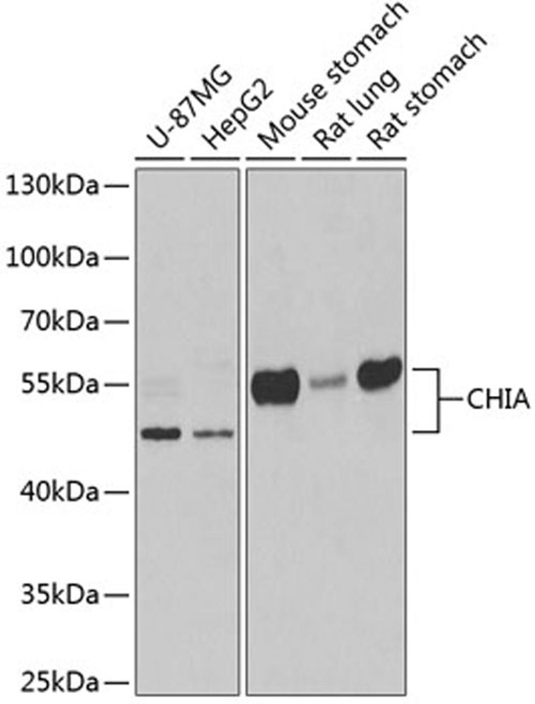 Western blot - CHIA antibody (A6558)