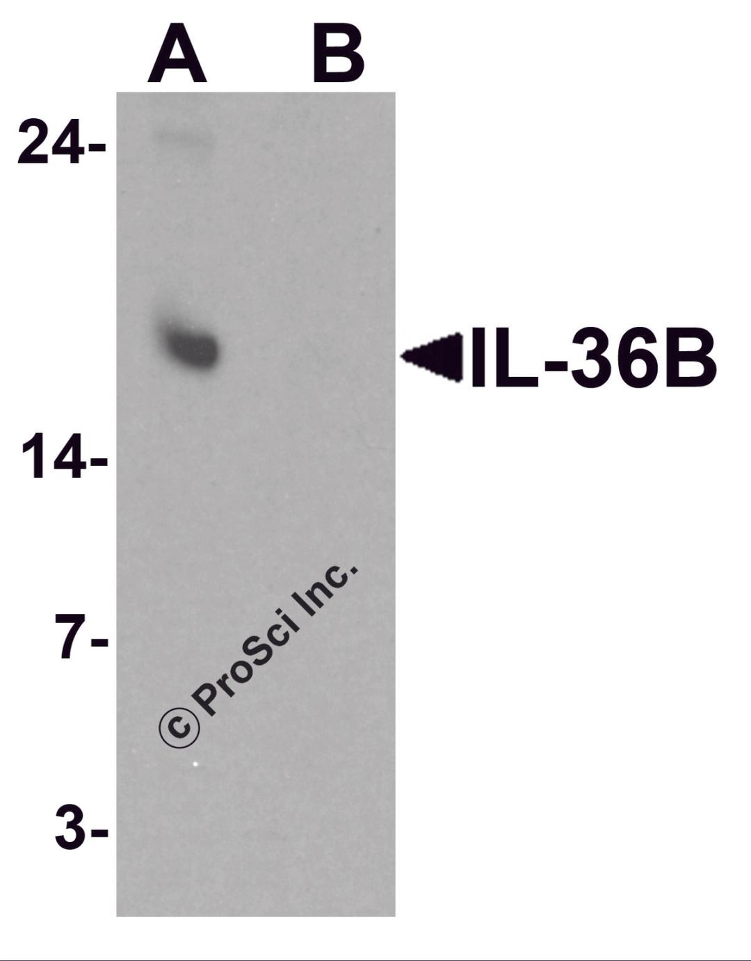 Western blot analysis of IL-36B in A549 cell lysate with IL-36B antibody at 1 &#956;g/ml in (A) the absence and (B) the presence of blocking peptide.