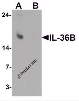 Western blot analysis of IL-36B in A549 cell lysate with IL-36B antibody at 1 &#956;g/ml in (A) the absence and (B) the presence of blocking peptide.