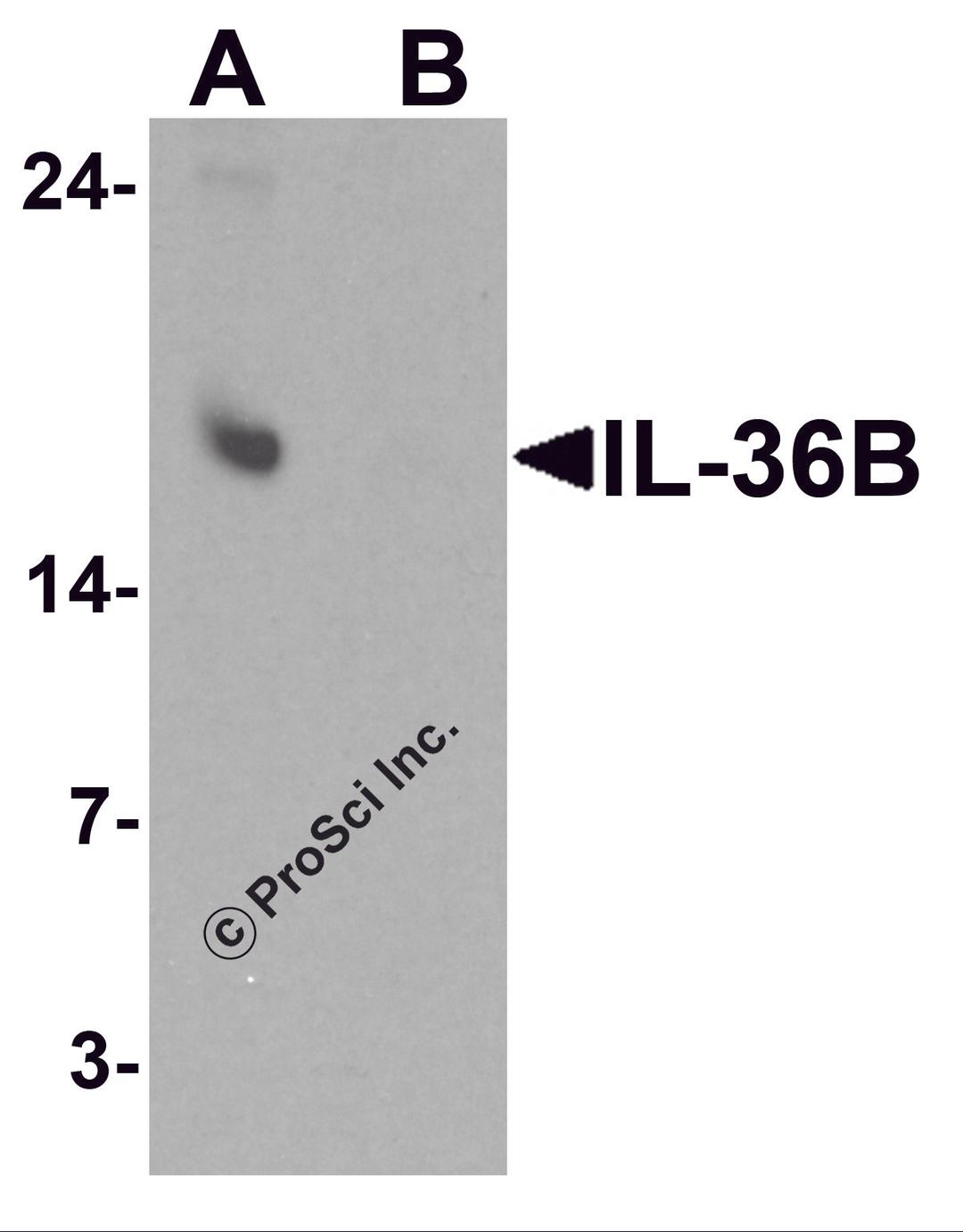 Western blot analysis of IL-36B in A549 cell lysate with IL-36B antibody at 1 μg/ml in (A) the absence and (B) the presence of blocking peptide.