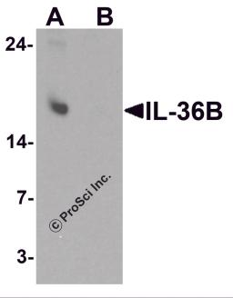 Western blot analysis of IL-36B in A549 cell lysate with IL-36B antibody at 1 μg/ml in (A) the absence and (B) the presence of blocking peptide.