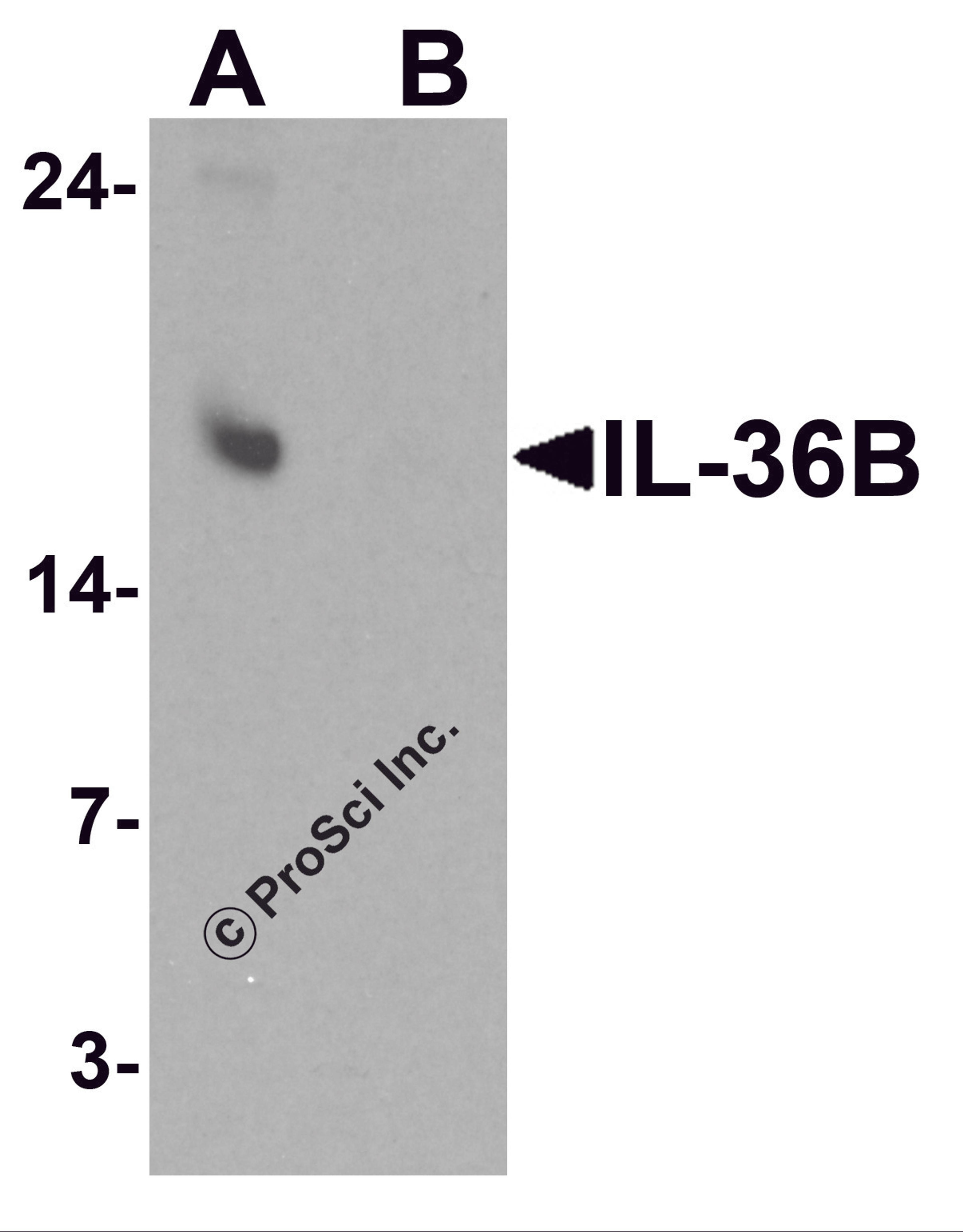 Western blot analysis of IL-36B in A549 cell lysate with IL-36B antibody at 1 μg/ml in (A) the absence and (B) the presence of blocking peptide.