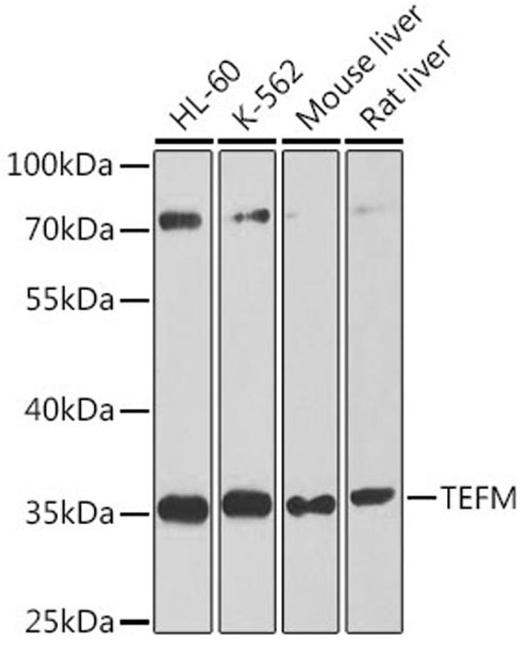 Western blot - TEFM antibody (A8511)