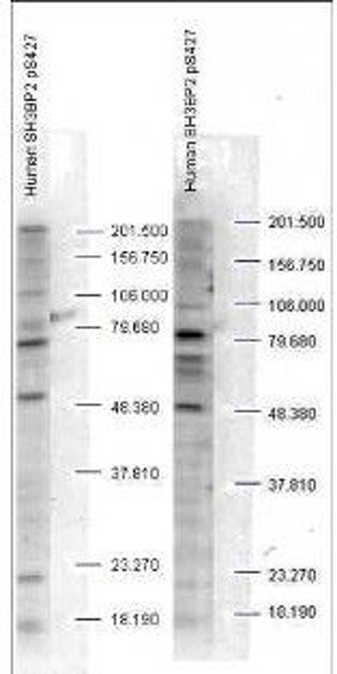 Western blot analysis of human whole cell lysates) using SH3BP2 (phospho-S427) antibody