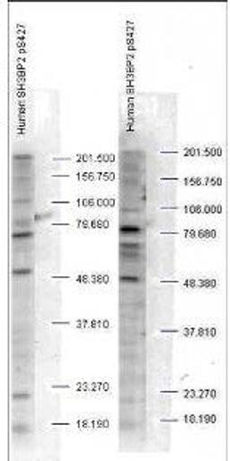 Western blot analysis of human whole cell lysates) using SH3BP2 (phospho-S427) antibody