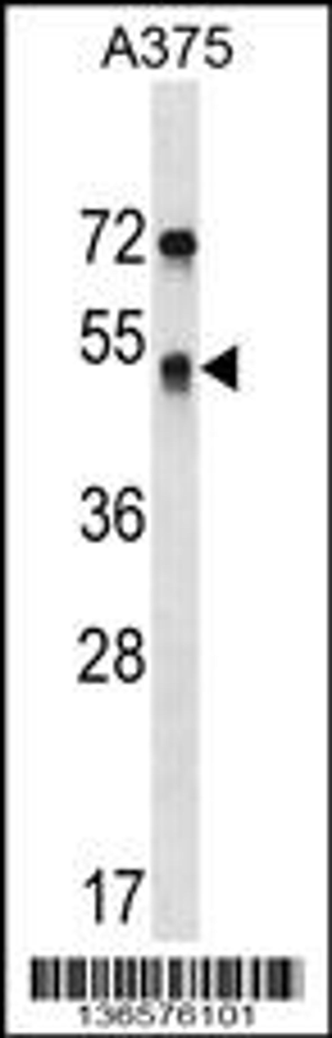 Western blot analysis in A375 cell line lysates (35ug/lane).